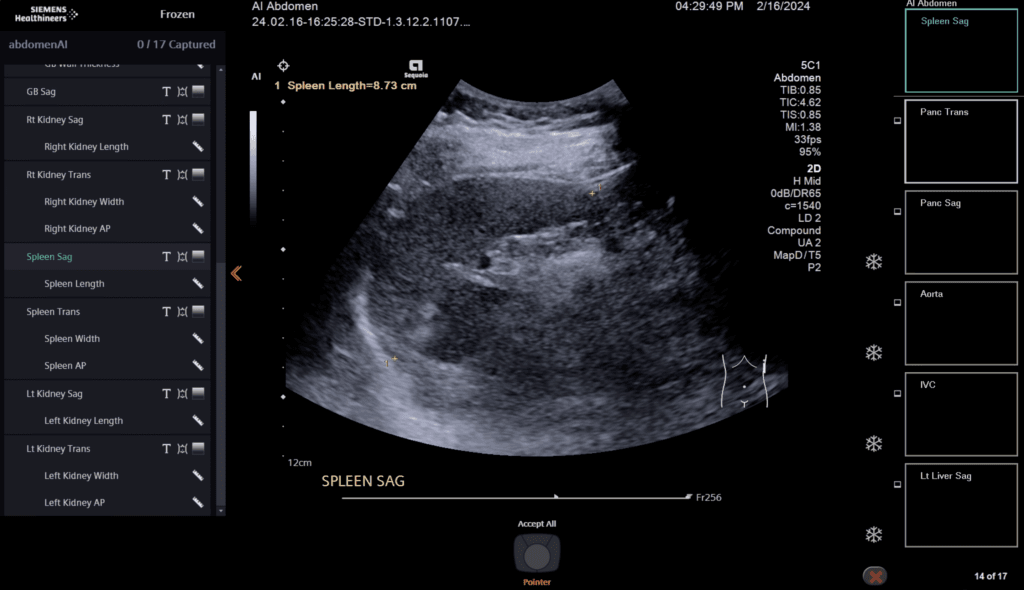 abdominale echografie